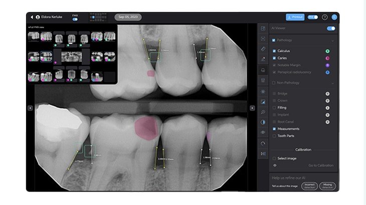 AI X-ray Analysis - AI-Powered Radiographic Diagnostics