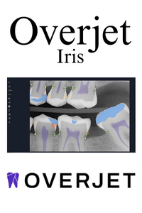 Overjet Iris - AI X-ray Detecting Software - AI.Dentist
